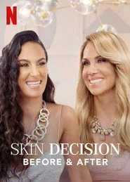 Skin Decision: Before and After posteri